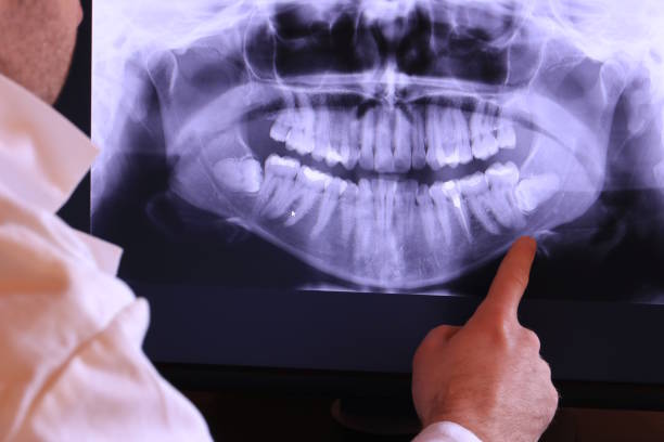 Best Emergency Treatment for Oral Infections in Waterville, ME