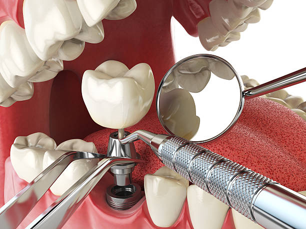 Best Emergency Root Canal Therapy in Waterville, ME